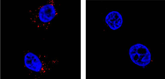 Zika Virus (red) is blocked with the loss of EMC1 (right) compared to control (left)